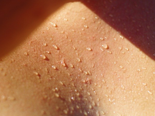 Excessive Sweating Featured Image